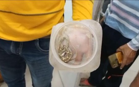 Unnao साँप को युवक ने डिब्बे मे क्यो बंद किया अस्पताल मे मचा हड़कंप