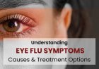 Widely spread bacterial and viral disease eye Flu